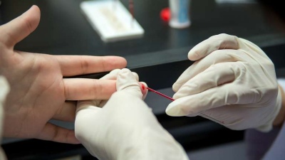 El municipio realiza testeos para la detección temprana del HIV